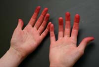 Dyer's Hands